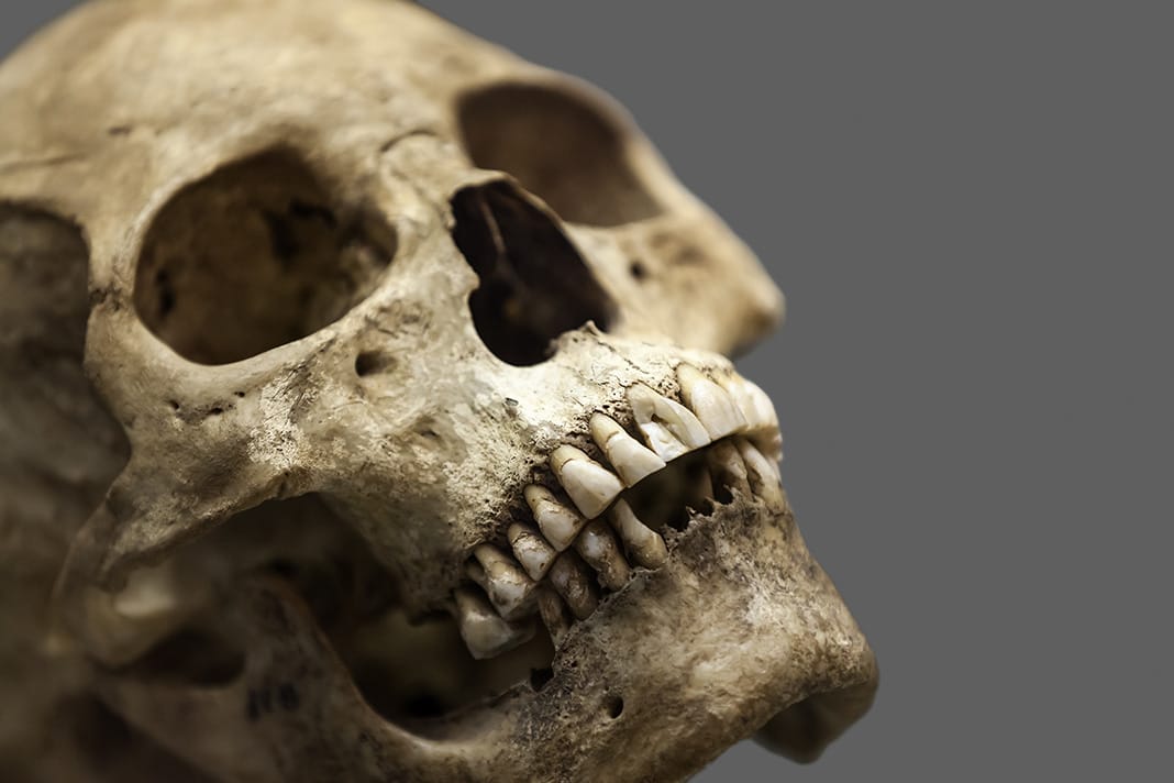 Human Skull, Jaw, and Teeth Evolution: Looking Beyond Dietary Changes Alone  - Today's RDH