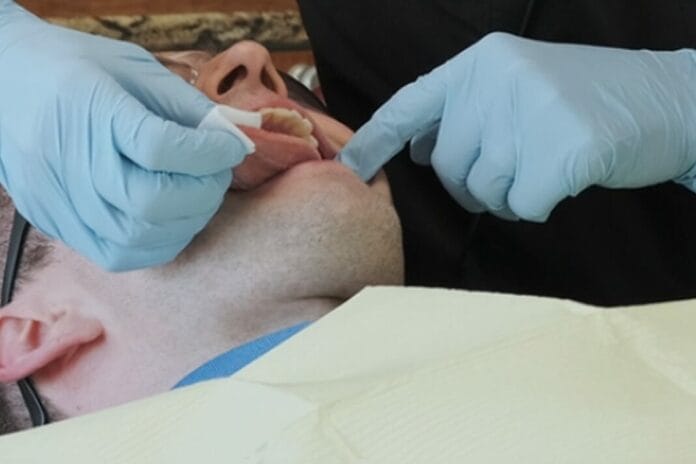 oral cancer screening