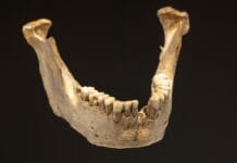 Ancient Teeth Reveal Insights into Evolution of Oral Microbiomes