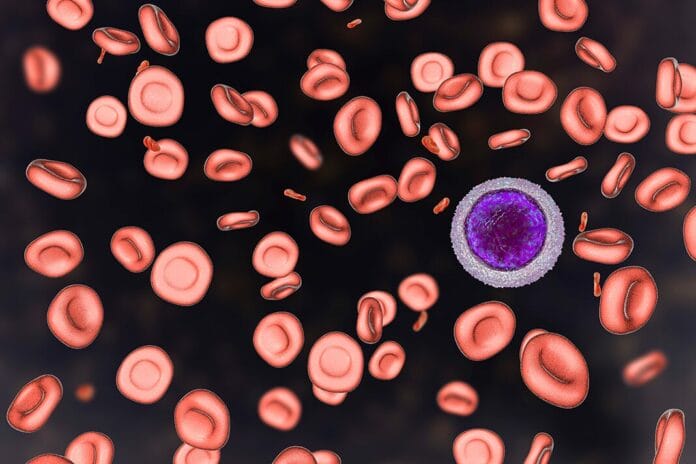 A Hygienist’s Overview of the Effects of Iron-Deficient Anemia on Oral Health