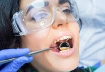 Researchers Assess Cost Effectiveness of Supportive Periodontal Care