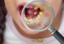 QUIZ: Test Your Oral Manifestations of Rare Diseases Knowledge