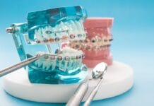 The History of Orthodontics from Ancient Egyptians to Modern Times