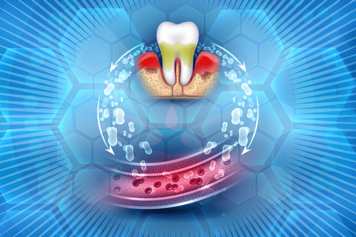 periodontal treatment type 2 diabetes