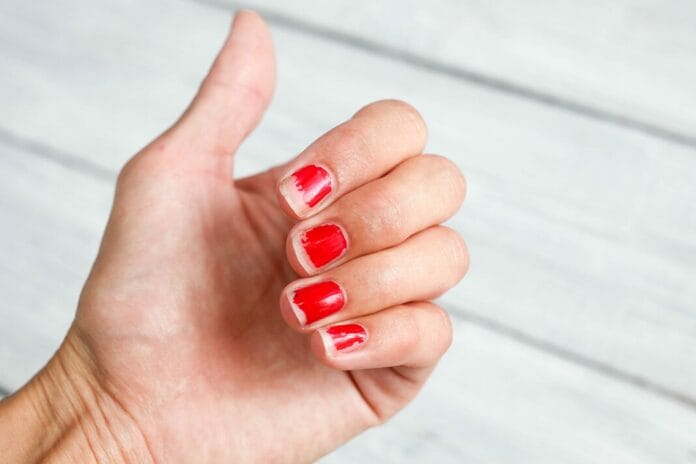 fingernail hygiene infection control