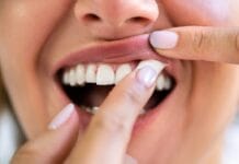 Systematic Review Evaluates the Oral Health Implications of Nicotine Pouch Use