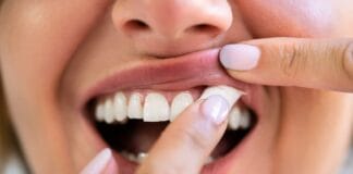 Systematic Review Evaluates the Oral Health Implications of Nicotine Pouch Use
