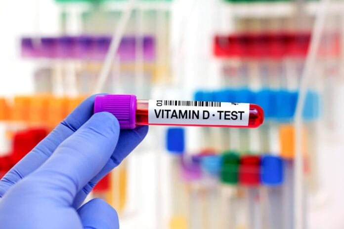 Systematic Review Examines the Association of Vitamin D and Dental Caries in Children