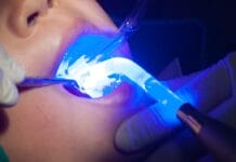 Researchers Compare Silver Diamine Fluoride vs Sealants for Community-Based Dental Caries Prevention